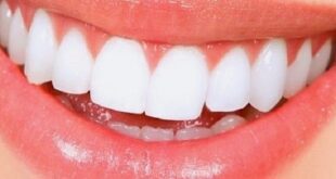 The best toothpaste5 310x165 - راه های سفید شدن دندان در دندانپزشکی