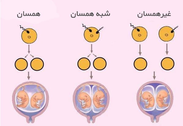 تخمک دوقلوی - 10 نکته ای که باید در مورد لقاح بدانید