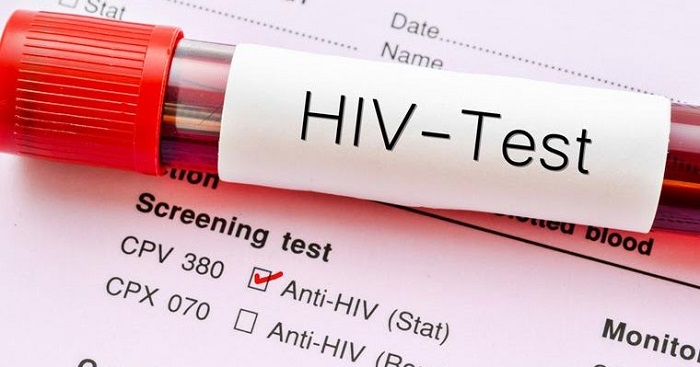 HIV test aids generic - فواید نیش زنبورهای زرد