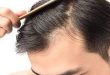 Teenboy hairfall 110x75 - علت ریزش مو در مردان جوان چیست