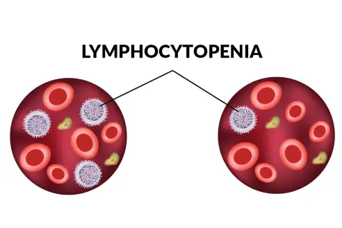 456456563 - بالا و پایین بودن lymphocyte در آزمایش خون نشانه چیست